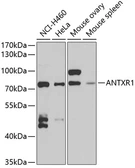 Anti-TEM8 antibody used in Western Blot (WB). GTX64680