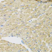 Anti-PIB5PA antibody used in IHC (Paraffin sections) (IHC-P). GTX64681