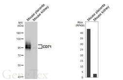 Anti-CD71 antibody [HL5775] used in Western Blot (WB). GTX646846