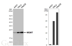 Anti-MGMT antibody [HL5777] used in Western Blot (WB). GTX646848