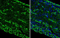Anti-alpha MSH antibody [HL5798] used in IHC (Paraffin sections) (IHC-P). GTX646869
