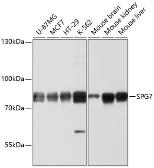 Anti-SPG7 antibody used in Western Blot (WB). GTX64687