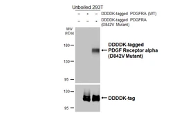 Anti-PDGF Receptor alpha (D842V Mutant) antibody [HL5800] used in Western Blot (WB). GTX646871