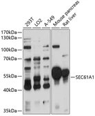 Anti-SEC61A1 antibody used in Western Blot (WB). GTX64692