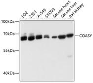 Anti-COASY antibody used in Western Blot (WB). GTX64695