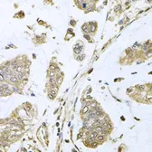 Anti-SBDS antibody used in IHC (Paraffin sections) (IHC-P). GTX64702
