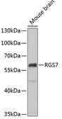 Anti-RGS7 antibody used in Western Blot (WB). GTX64703