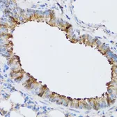 Anti-ARD1A antibody used in IHC (Paraffin sections) (IHC-P). GTX64704