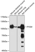 Anti-PYGM antibody used in Western Blot (WB). GTX64709