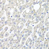 Anti-OTC antibody used in IHC (Paraffin sections) (IHC-P). GTX64710