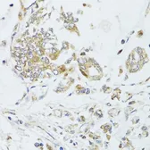 Anti-MAD2L2 antibody used in IHC (Paraffin sections) (IHC-P). GTX64711