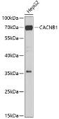 Anti-Cav beta 1 antibody used in Western Blot (WB). GTX64713