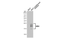 Anti-HE4 antibody [HL5819] used in Western Blot (WB). GTX647137