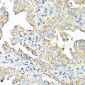 Anti-eIF3B antibody used in IHC (Paraffin sections) (IHC-P). GTX64714