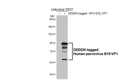 Anti-Human parvovirus B19 VP1 antibody [HL5827] used in Western Blot (WB). GTX647145
