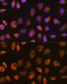 Anti-SEL1L antibody used in Immunocytochemistry/ Immunofluorescence (ICC/IF). GTX64717