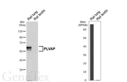Anti-PLVAP antibody [HL5858] used in Western Blot (WB). GTX647176