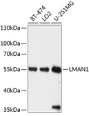 Anti-LMAN1 antibody used in Western Blot (WB). GTX64719