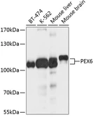 Anti-PEX6 antibody used in Western Blot (WB). GTX64720