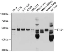 Anti-MST3 antibody used in Western Blot (WB). GTX64721