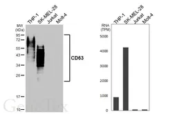 Anti-CD63 antibody [HL5891] used in Western Blot (WB). GTX647215
