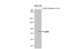 Anti-p73 antibody [HL5894] used in Western Blot (WB). GTX647218