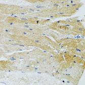 Anti-MAP1 antibody used in IHC (Paraffin sections) (IHC-P). GTX64722