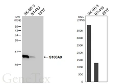 Anti-S100A9 antibody [HL5896] used in Western Blot (WB). GTX647220