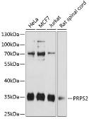 Anti-PRPS2 antibody used in Western Blot (WB). GTX64723