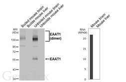 Anti-EAAT1 antibody [HL5913] used in Western Blot (WB). GTX647238