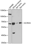 Anti-Activin Receptor Type IIA antibody used in Western Blot (WB). GTX64724