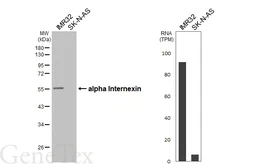 Anti-alpha Internexin antibody [HL5916] used in Western Blot (WB). GTX647241