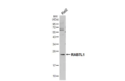 Anti-RAB7L1 antibody [HL5929] used in Western Blot (WB). GTX647254