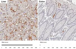 Anti-alpha 1 Antitrypsin antibody [HL5931] used in IHC (Paraffin sections) (IHC-P). GTX647256