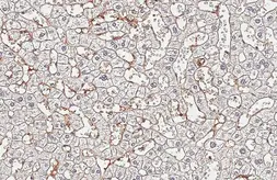 Anti-Fibrinogen alpha antibody [HL5932] used in IHC (Paraffin sections) (IHC-P). GTX647257