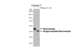 Anti-Neuroserpin antibody [HL5935] used in Western Blot (WB). GTX647260