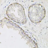 Anti-CIB1 antibody used in IHC (Paraffin sections) (IHC-P). GTX64728