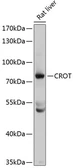 Anti-CROT antibody used in Western Blot (WB). GTX64729
