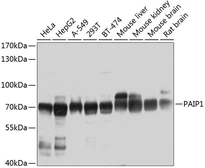 Anti-PAIP1 antibody used in Western Blot (WB). GTX64732