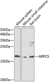 Anti-p16 ARC antibody used in Western Blot (WB). GTX64739