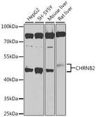 Anti-AChR beta 2 antibody used in Western Blot (WB). GTX64742