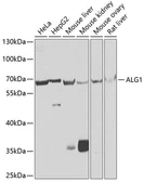 Anti-ALG1 antibody used in Western Blot (WB). GTX64746