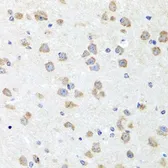 Anti-CHD1 antibody used in IHC (Paraffin sections) (IHC-P). GTX64749
