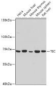 Anti-TEC antibody used in Western Blot (WB). GTX64753