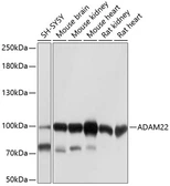 Anti-ADAM22 antibody used in Western Blot (WB). GTX64755