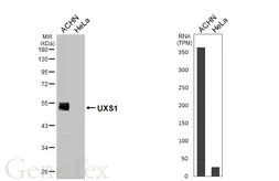 Anti-UXS1 antibody [HL5946] used in Western Blot (WB). GTX647558