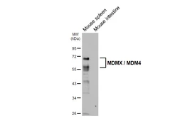 Anti-MDMX / MDM4 antibody [HL5947] used in Western Blot (WB). GTX647559