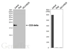 Anti-CD3 delta antibody [HL5955] used in Western Blot (WB). GTX647567