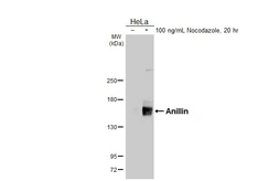 Anti-Anillin antibody [HL5957] used in Western Blot (WB). GTX647569