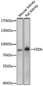 Anti-Frizzled 6 antibody used in Western Blot (WB). GTX64757